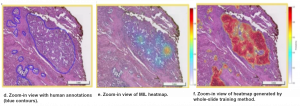 An annotation-free whole-slide training approach to pathological classification of lung cancer types using deep learning