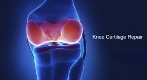 Knee Cartilage Repair Market