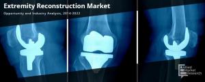 Extremity Reconstruction Market | Stemless shoulder implants segment is projected to grow at CAGR of 20%.