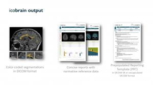 icobrain output includes color-coded segmentations in DICOM format, concise reports with normative reference data, and pre-populated reporting templates.