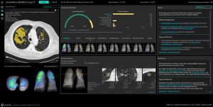 STATdx and contextflow announce partnership to provide radiologists with improved tools to tackle differential diagnoses
