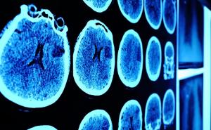 AI on clinical Scans Market Size To grow at considerable rate during the forecast period (2022-2028)