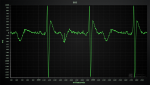  An electrocardiogram (ECG) chart made in JavaScript with LightningChart JS