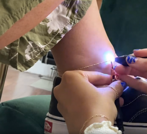Welding Of Permanent Anklet