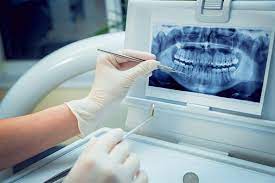 Dental-Imaging-Devices-Market