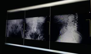 X-ray of 3 pelvises