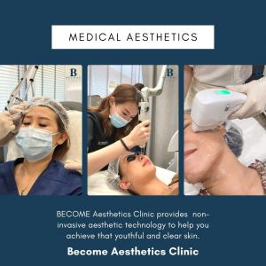 Become Aesthetics Clinic services Singapore