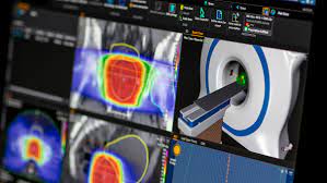 Treatment Planning Systems And Advanced Image Processing Market Analysis and Demand by 2031