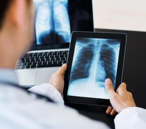 Digital Radiography Market