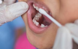 Fluoride Varnish Market