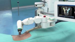 Spinal Surgical Robots Market Recent Developments and SWOT Analysis 2031