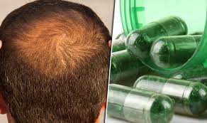 Hair Loss Supplement Market