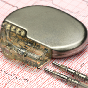 Medtronic and Abbott Lead the U.S. Pacemaker Market in Revenue and ...