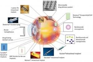Sustained Release Ocular Drug Delivery Systems Market Trend | Demand and Import/Export Details up to 2031
