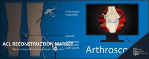 ACL Reconstruction Market