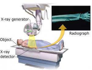 X-Ray Detector Market