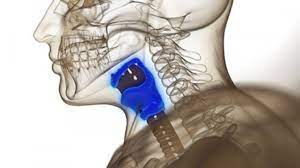 Artificial Larynx Market