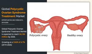 Polycystic Ovarian Syndrome Treatment Market Research