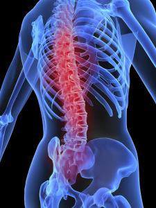 Back Pain.