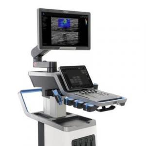 Global Ultrasound Elastography Systems Market Share