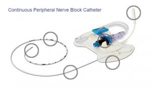 Continuous Peripheral Nerve Block Catheter Market