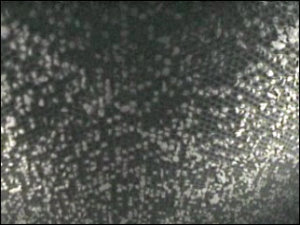 Large particle ash buildup on a catalyst