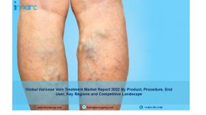 Varicose Vein Treatment Market