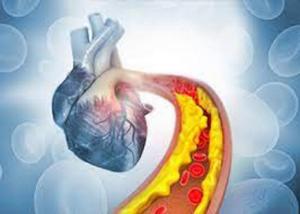 Global Lipid Disorder Treatment Market