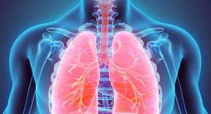 Global Lung Cancer Diagnostics Market
