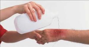 Global Burn Injury Treatment Market