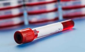 Global Blood Collection Market