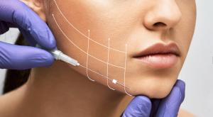 threadlift scottsdale