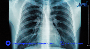 Elastography Imaging Market Size