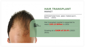 Hair Transplant Market Demand