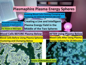 A photo of plasma energy spheres set up for home use with a plasma sphere on each side of the bed.