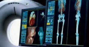 Computer Aided Detection Market Industry