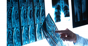 Augnito speech recognition in radiology reporting