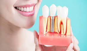 Dental Implants and Prosthesis Market