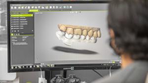 This is a picture of some of the modern technology our Mexico dental office uses