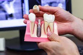 Dental Simulator Market
