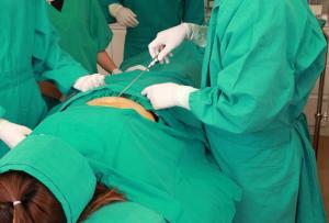 Liposuction Surgical Procedures Market