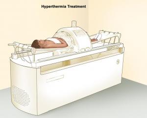 Hyperthermia Devices Market