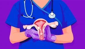 Ovarian Cancer Market