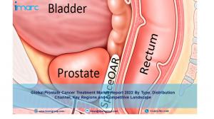 Prostate Cancer Treatment Market