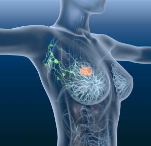 Breast Cancer Liquid Biopsy Market