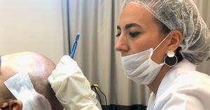Hair Transplant Turkey - Performing by Dermatolog Dr. Celen