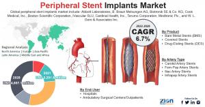 Global Peripheral Stent Implants Market