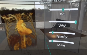 CT Scan 3D reconstructed