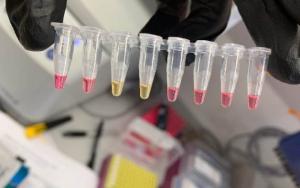 Virology Testing Market