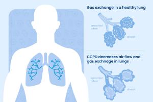 Asthma & COPD Market